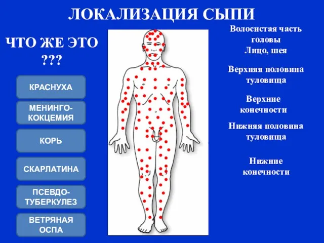 ЛОКАЛИЗАЦИЯ СЫПИ Верхние конечности Нижние конечности Нижняя половина туловища Лицо, шея