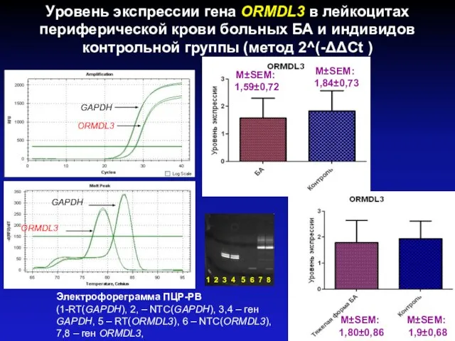 Уровень экспрессии гена ORMDL3 в лейкоцитах периферической крови больных БА и
