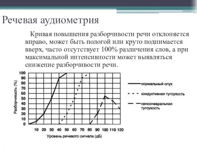 Речевая аудиометрия Кривая повышения разборчивости речи отклоняется вправо, может быть пологой