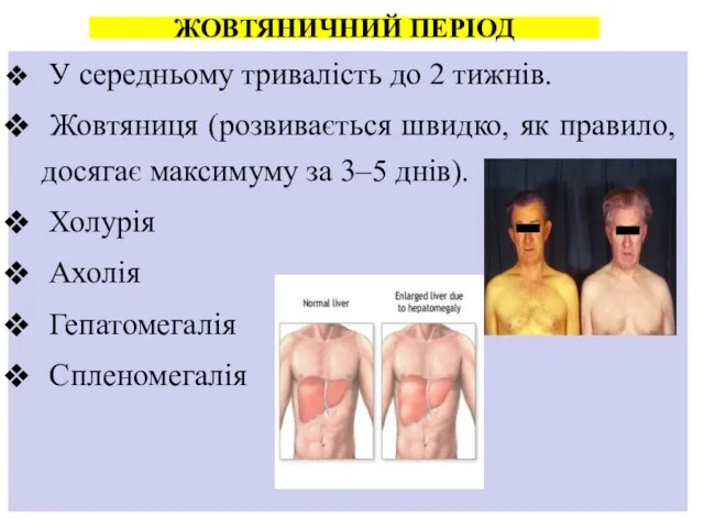 У середньому тривалість до 2 тижнів. Жовтяниця (розвивається швидко, як правило,