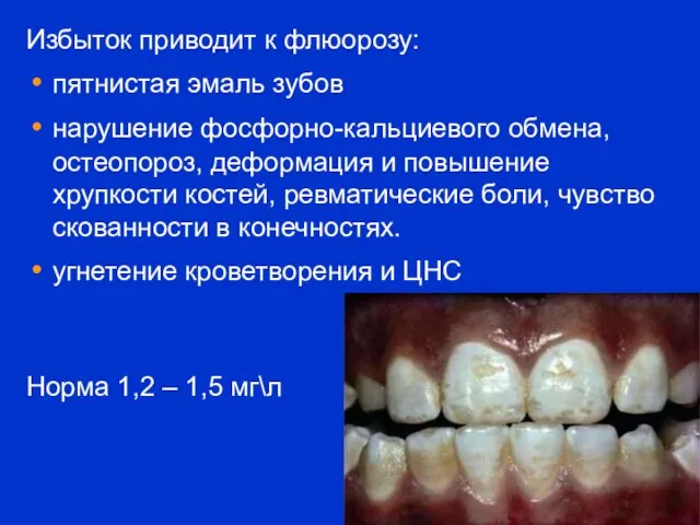 Избыток приводит к флюорозу: пятнистая эмаль зубов нарушение фосфорно-кальциевого обмена, остеопороз,