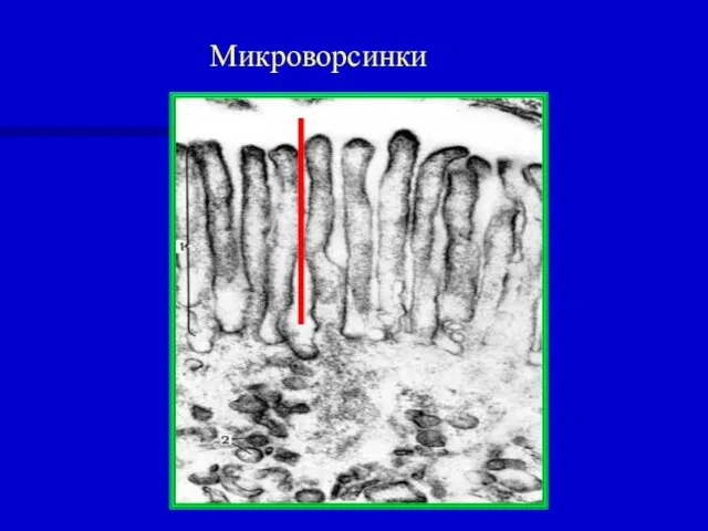 Микроворсинки