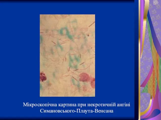 Мікроскопічна картина при некротичній ангіні Симановського-Плаута-Венсана