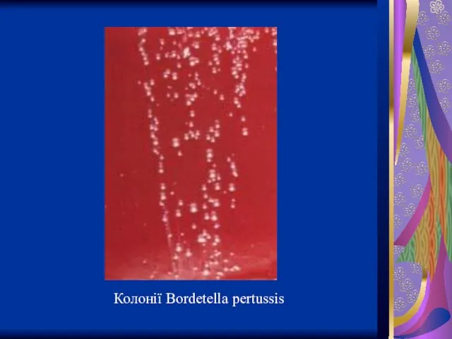 Колонії Bordetella pertussis