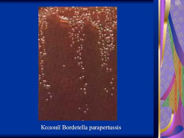 Колонії Bordetella parapertussis