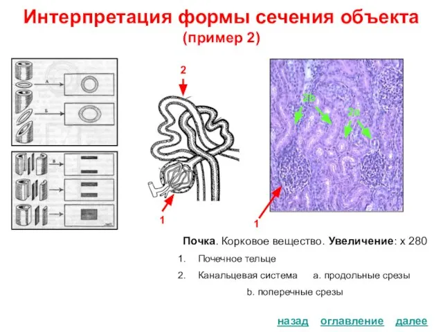 Интерпретация формы сечения объекта (пример 2) Почка. Корковое вещество. Увеличение: х