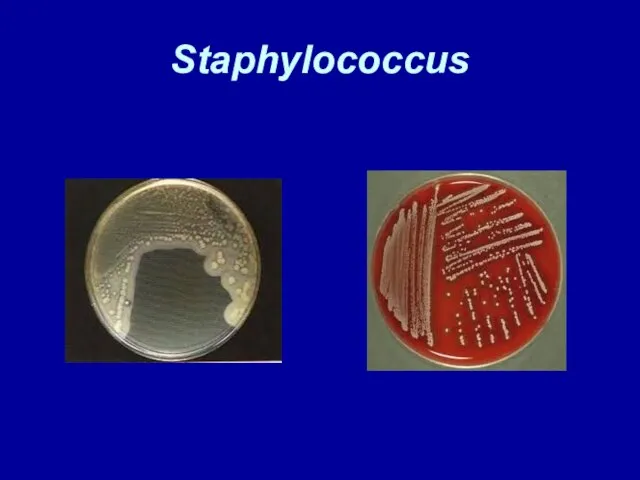 Staphylococcus