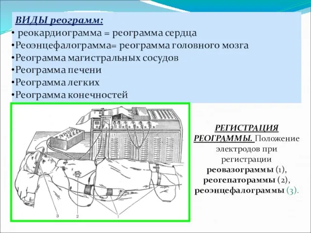 ВИДЫ реограмм: реокардиограмма = реограмма сердца Реоэнцефалограмма= реограмма головного мозга Реограмма