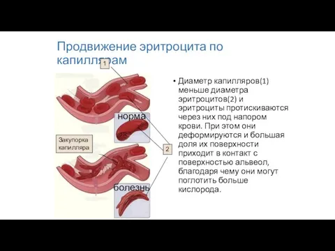 Продвижение эритроцита по капиллярам Диаметр капилляров(1) меньше диаметра эритроцитов(2) и эритроциты