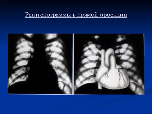 Рентгенограммы в прямой проекции