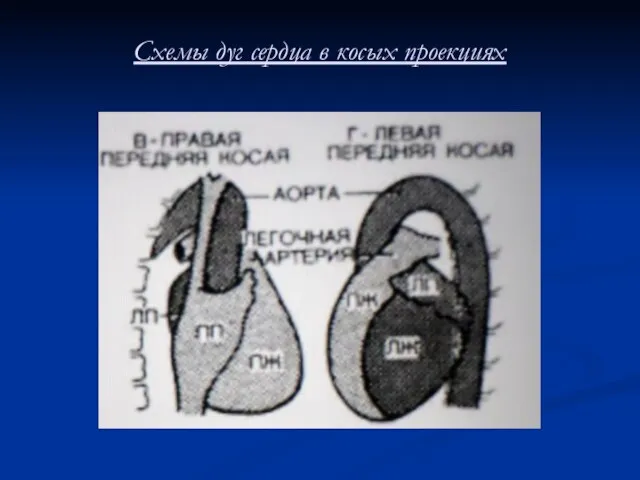 Схемы дуг сердца в косых проекциях