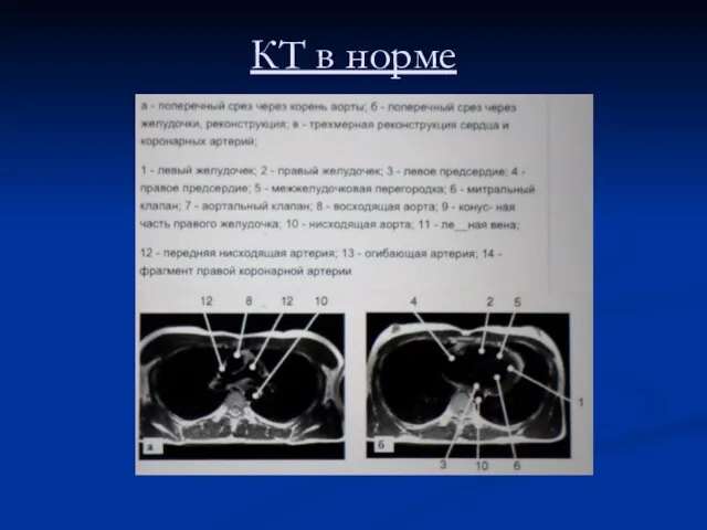 КТ в норме