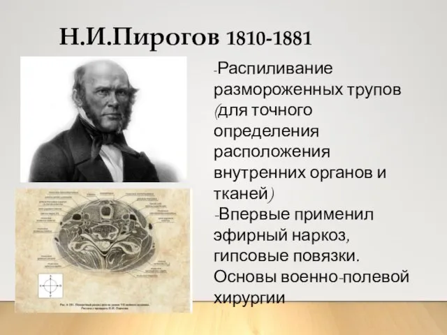 Н.И.Пирогов 1810-1881 -Распиливание размороженных трупов (для точного определения расположения внутренних органов