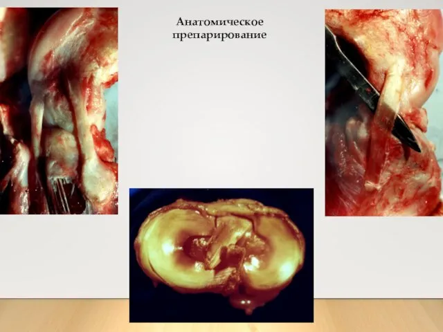 Анатомическое препарирование