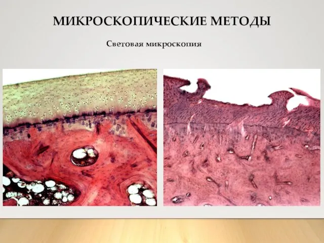 МИКРОСКОПИЧЕСКИЕ МЕТОДЫ Световая микроскопия