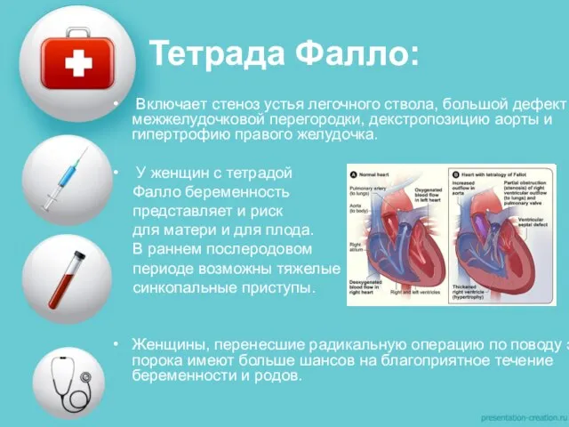 Тетрада Фалло: Включает стеноз устья легочного ствола, большой дефект межжелудочковой перегородки,