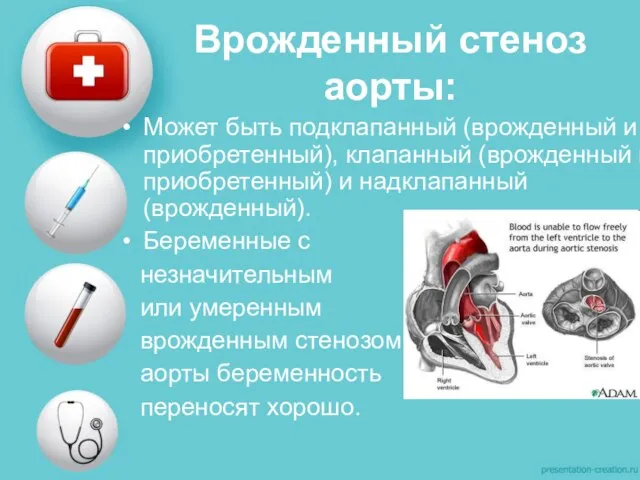 Врожденный стеноз аорты: Может быть подклапанный (врожденный и приобретенный), клапанный (врожденный