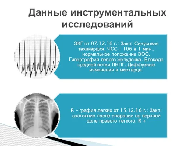 Данные инструментальных исследований