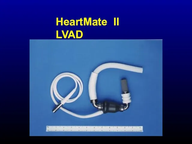 HeartMate II LVAD