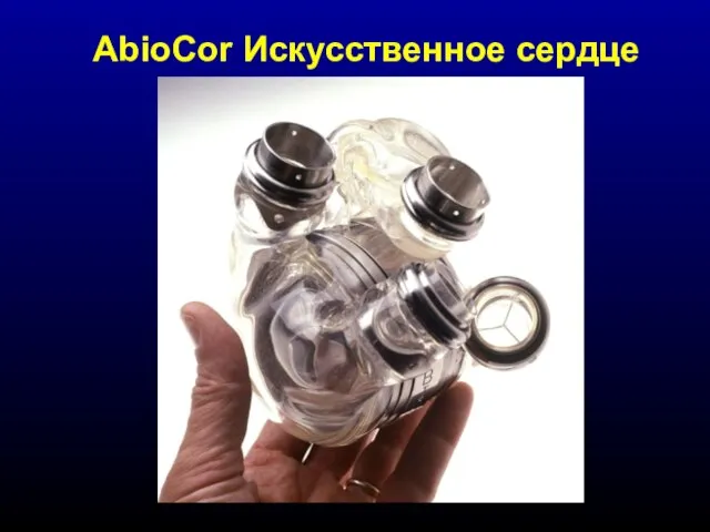 AbioCor Искусственное сердце