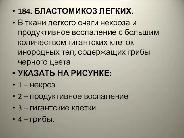 184. БЛАСТОМИКОЗ ЛЕГКИХ. В ткани легкого очаги некроза и продуктивное воспаление