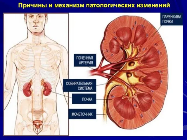 Причины и механизм патологических изменений