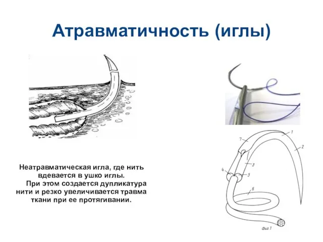 Атравматичность (иглы) Неатравматическая игла, где нить вдевается в ушко иглы. При