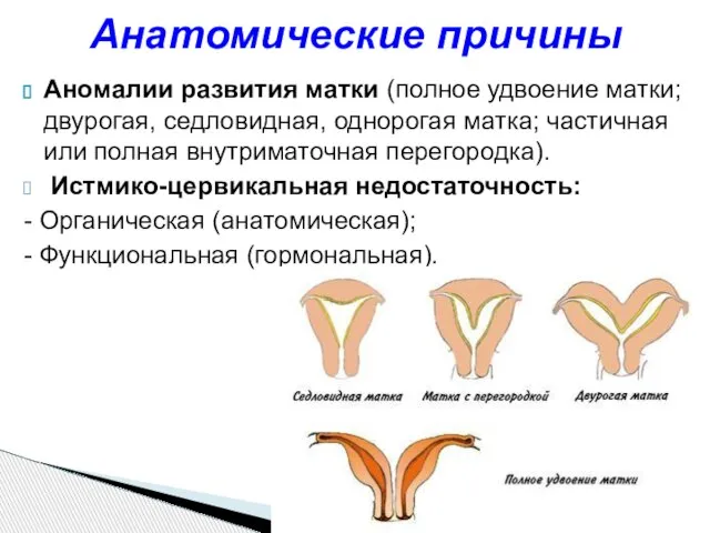 Аномалии развития матки (полное удвоение матки; двурогая, седловидная, однорогая матка; частичная