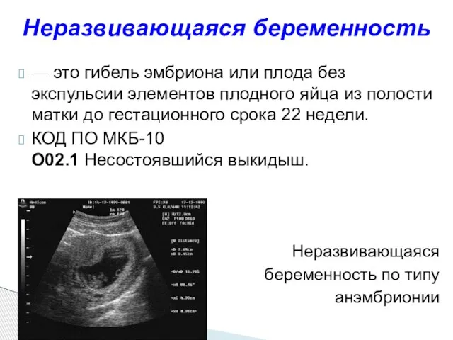 — это гибель эмбриона или плода без экспульсии элементов плодного яйца