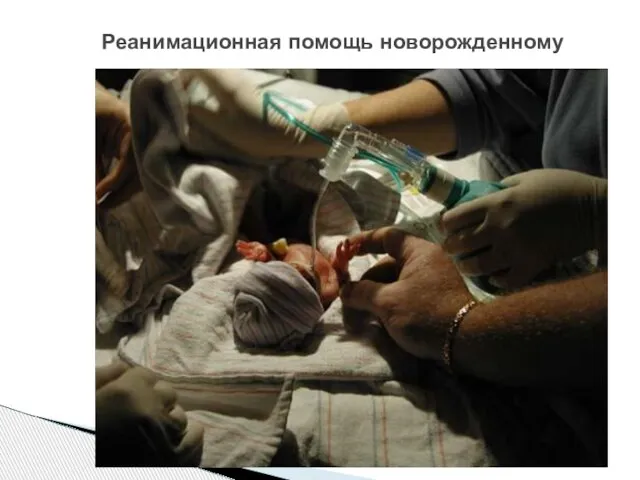 Реанимационная помощь новорожденному