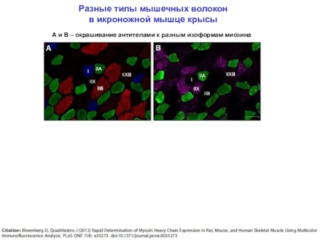 Разные типы мышечных волокон в икроножной мышце крысы А и В