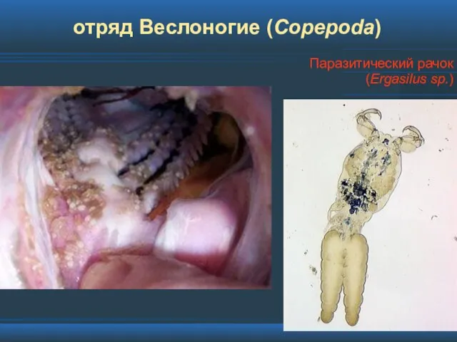 отряд Веслоногие (Copepoda) Паразитический рачок (Ergasilus sp.)