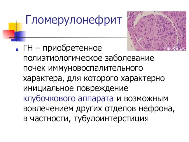 Гломерулонефрит ГН – приобретенное полиэтиологическое заболевание почек иммуновоспалительного характера, для которого