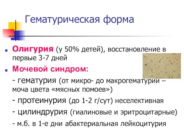 Гематурическая форма Олигурия (у 50% детей), восстановление в первые 3-7 дней