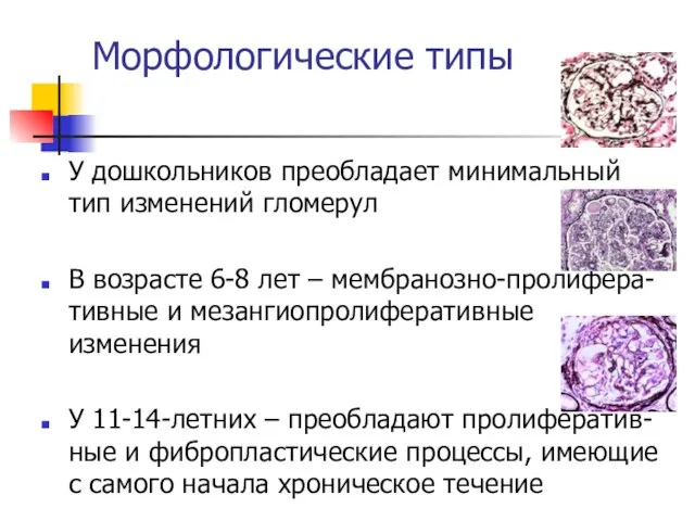 Морфологические типы У дошкольников преобладает минимальный тип изменений гломерул В возрасте