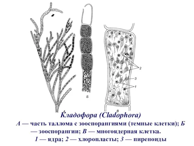 Кладофора (Cladophora) А — часть таллома с зооспорангиями (темные клетки); Б