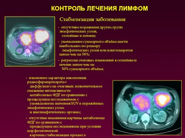 Стабилизация заболевания отсутствие поражения других групп лимфатических узлов, селезёнки и печени;