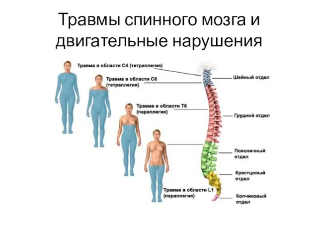 Травмы спинного мозга и двигательные нарушения