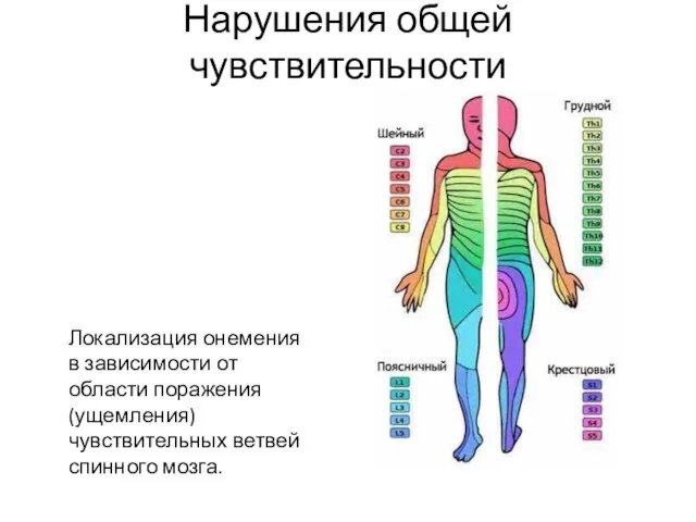 Нарушения общей чувствительности Локализация онемения в зависимости от области поражения (ущемления) чувствительных ветвей спинного мозга.