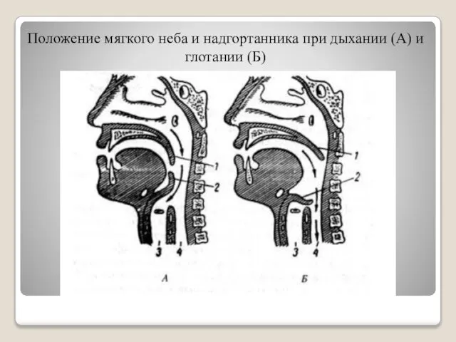 Положение мягкого неба и надгортанника при дыхании (А) и глотании (Б)