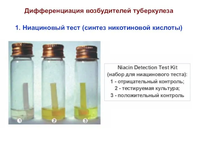 Дифференциация возбудителей туберкулеза 1. Ниациновый тест (синтез никотиновой кислоты)