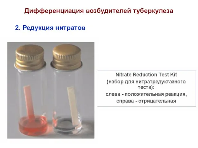 2. Редукция нитратов Дифференциация возбудителей туберкулеза