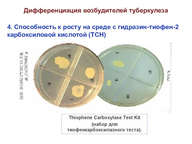 Дифференциация возбудителей туберкулеза 4. Способность к росту на среде с гидразин-тиофен-2 карбоксиловой кислотой (ТСН)