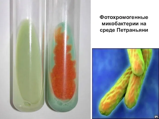Фотохромогенные микобактерии на среде Петраньяни
