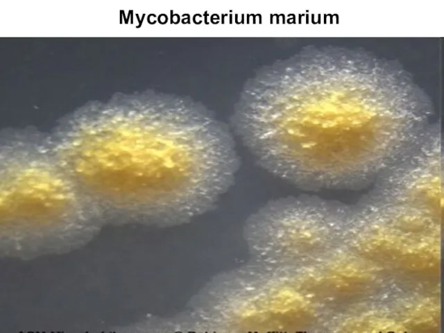 Mycobacterium marium