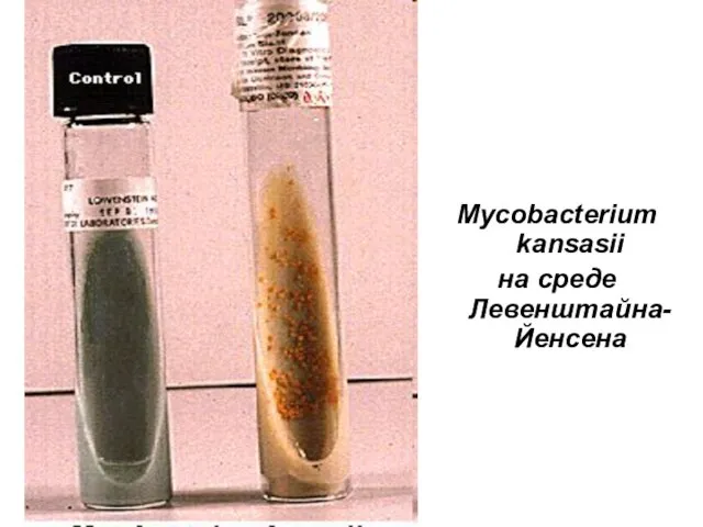 Mycobacterium kansasii на среде Левенштайна-Йенсена