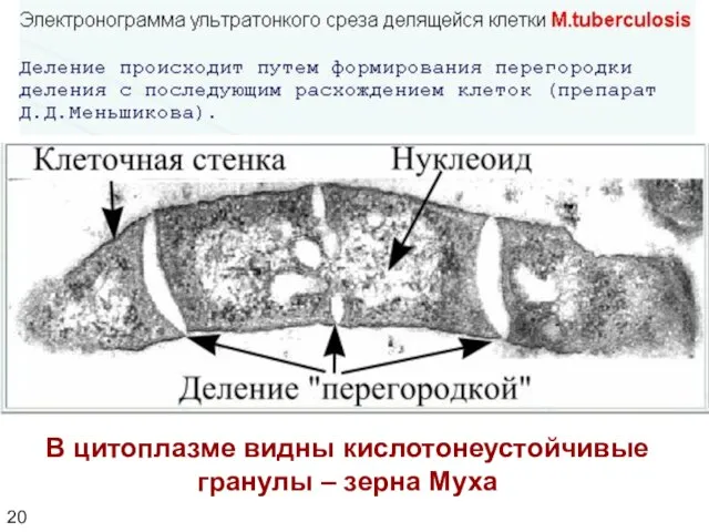 20 В цитоплазме видны кислотонеустойчивые гранулы – зерна Муха