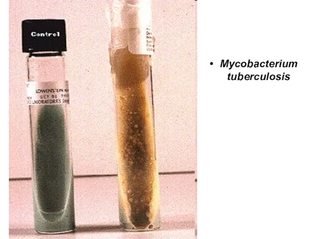 Mycobacterium tuberculosis