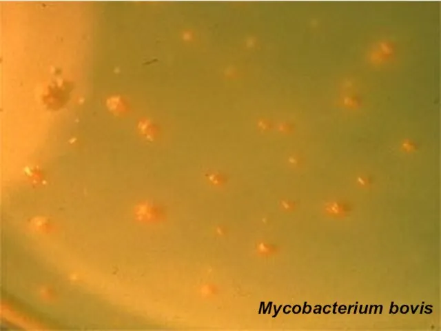 Mycobacterium bovis