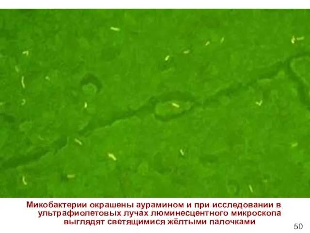 Микобактерии окрашены аурамином и при исследовании в ультрафиолетовых лучах люминесцентного микроскопа выглядят светящимися жёлтыми палочками 50